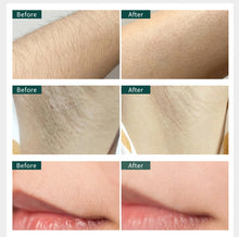 Load image into Gallery viewer, 990000 Laser Hair Removal Machine Laser Epilator for Women Hair Removal